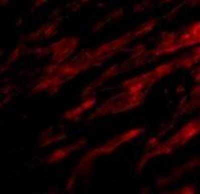 Immunocytochemistry/Immunofluorescence: B7-H1/PD-L1/CD274 Antibody [NBP1-76769] - Human Heart cells.