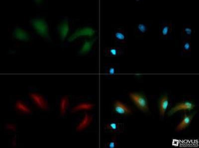 Immunocytochemistry/Immunofluorescence: EGLN1/PHD2 Antibody [NB100-137] - Staining of PHD2 in HeLa cells with Dylight 488 (green). Nuclei and alpha-tubulin were counterstained with DAPI (blue) and Dylight 550 (red).