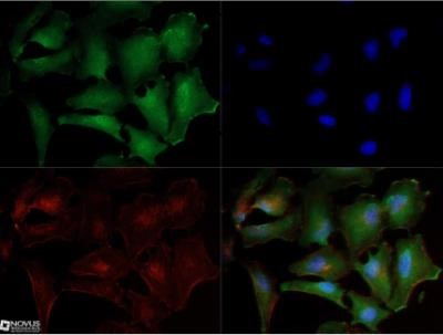 Immunocytochemistry/Immunofluorescence: Noxa Antibody (114C307.1) [NB600-1159] - Analysis using Azide Free version of NB600-1159. HeLa cells with Dylight 488 (green). Nuclei and alpha-tubulin were counterstained with DAPI (blue) and Dylight 550 (red). An antibody dilution of 1:10 was used. Image objective 40x.