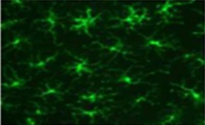 Immunocytochemistry/Immunofluorescence: Langerin/CD207 Antibody (929F3.01) [DDX0362P-100] - Mouse epidermal sheet.