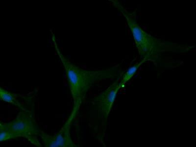 Immunocytochemistry/Immunofluorescence: Nox4 Antibody [NB110-58849] - Porcine aortic endothelial cells stained with  (green). Nuclei were counterstained with DAPI (blue). Image from verified customer review.