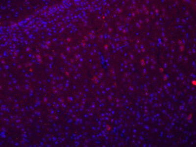 Immunocytochemistry/Immunofluorescence: Nox4 Antibody [NB110-58849] - Detection of NOX4 in mouse brain showing positive staining in neurons in the cortex. Image provided by Rachel Reith.