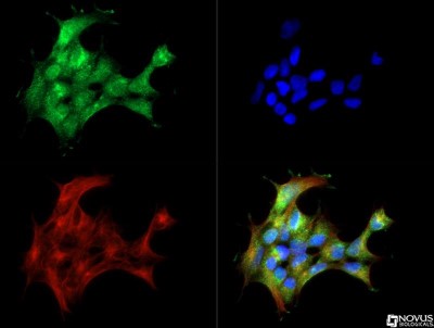 Immunocytochemistry/Immunofluorescence: Nox4 Antibody [NB110-58849] - NOX4 antibody was tested in Hek293 cells with DyLight 488 (green). Nuclei and alpha-tubulin were counterstained with DAPI (blue) and Dylight 550 (red).