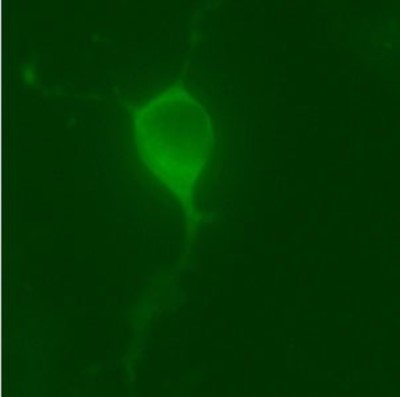 Immunocytochemistry/Immunofluorescence: LRRK2 Antibody [NB300-268] - Mouse CAD cells transfected with Human wild-type LRRK-2 (1:2,000).