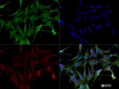 Immunocytochemistry/Immunofluorescence: LRRK2 Antibody [NB300-268] - LRRK2 antibody was tested in SH-SY-5Y cells at a 1:200 dilution against Dylight 488 (Green). Alpha tubulin and nuclei were counterstained against Dylight 568 (Red), and DAPI (Blue), respectively.