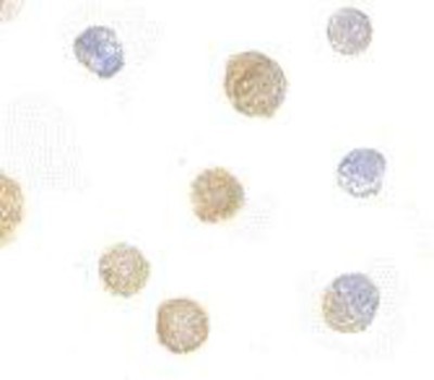 Immunocytochemistry/Immunofluorescence: FYB/ADAP/SLAP130 Antibody [NBP1-76810] - K562 cells with FYB antibody at 10 ug/ml.