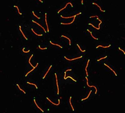 Immunocytochemistry/Immunofluorescence: SCP3/SYCP3 Antibody [NB300-232] - SCP3 Antibody [NB300-232] - SCP3 labeled in mouse pachytene preparation (red), using NB300-232 SCP3 antibody. CDK2 staining, near teleomeres, is also present (green).