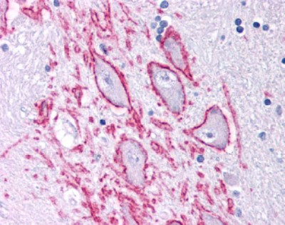 Immunohistochemistry: Neurokinin 1 Receptor Antibody [NB300-119] - Staining of brain, basal nucleus of Meynert, neurons.