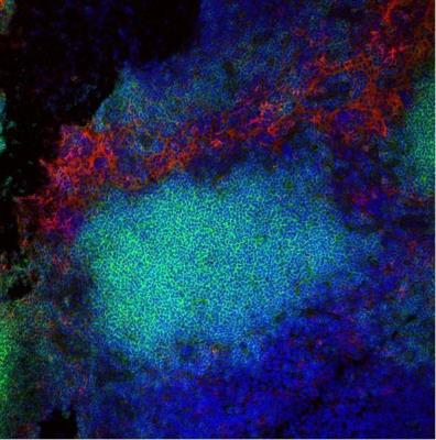 Immunocytochemistry/Immunofluorescence: F4/80 Antibody (CI-A3-1) [NB600-404] - Lymph node stained for macrophages, red and B cells CD79b, green; nuclei are stained with DAPI, blue