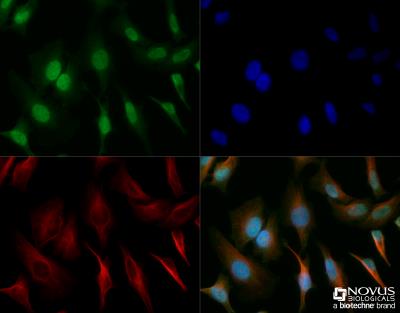 Immunocytochemistry/Immunofluorescence: SOX2 Antibody [NB110-37235] - HeLa cells were fixed for 10 minutes using 10% formalin and then permeabilized for 5 minutes using 1X TBS + 0.5% Triton-X100. The cells were incubated with anti-SOX2 (NB110-37235) at a 1:200 dilution overnight at 4C and detected with an anti-rabbit Dylight 488 (Green) at a 1:500 dilution. Alpha tubulin was used as a co-stain at a 1:1000 dilution and detected with and anti-mouse Dylight 550 (Red) at a 1:500 dilution. Nuclei were counterstained with DAPI (Blue). Cells were imaged using a 40X objective.