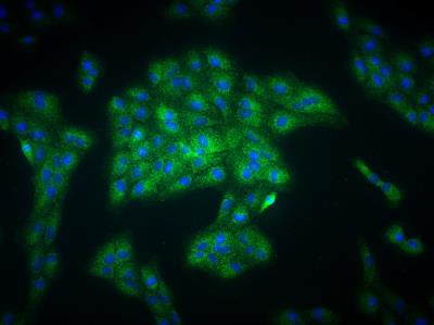 Immunocytochemistry/Immunofluorescence: EGLN1/PHD2 Antibody [NB100-2219] - Analysis of EGLN1/PHD2 in ARPE-19 cells using anti-PHD2 antibody. Image from veriifed customer review.