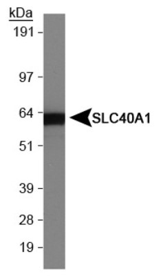 Western Blot: Ferroportin/SLC40A1 Antibody [NBP1-21502] - Human intestine lysate.
