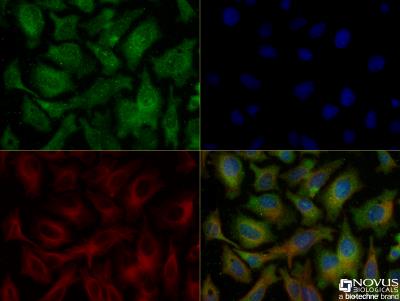 Immunocytochemistry/Immunofluorescence: Ferroportin/SLC40A1 Antibody [NBP1-21502] - HepG2 cells were fixed and permeabilized for 10 minutes using -20C MeOH. The cells were incubated with anti-Ferroportin 1 at 5.0 ug/ml overnight at 4C and detected with an anti-rabbit Dylight 488 (Green) at a 1:500 dilution. Alpha tubulin (DM1A) [NB100-690] was used as a co-stain at a 1:1000 dilution and detected with an anti-mouse Dylight 550 (Red) at a 1:500 dilution. Nuclei were counterstained with DAPI (Blue). Cells were imaged using a 40X objective.