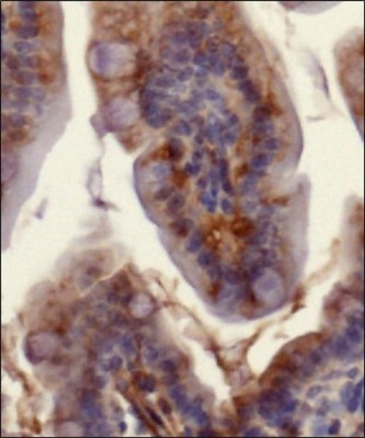 Immunohistochemistry-Paraffin: Ferroportin/SLC40A1 Antibody [NBP1-21502] - IHC-P detection of FPN1 / SLC40A1 protein in murine small intestinal section using Ferroportin 1 antibody at a dilution of 1:200. The antibody primarily developed a membranous staining pattern in the intestinal epithelial cells.