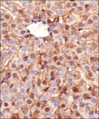 Immunohistochemistry-Paraffin: Ferroportin/SLC40A1 Antibody [NBP1-21502] - IHC-P detection of FPN1 / SLC40A1 protein in murine liver section using Ferroportin 1 antibody at a dilution of 1:200. The representative image shows intense staining in the cellular membranes, whereas, a relatively milder postivity was observed in the cytoplasm of hepatocytes.