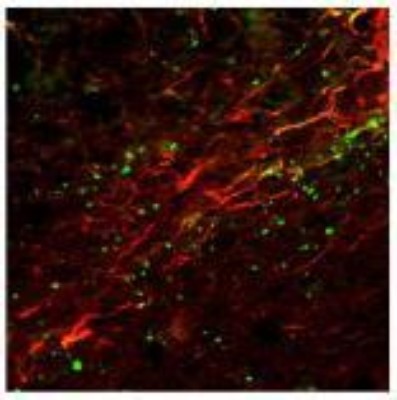 Immunocytochemistry/Immunofluorescence: Neurokinin 1 Receptor Antibody [NB300-101] - IF analysis of Neurokinin 1 Receptor in rat brain tissue. Image courtesy of anonymous customer product review.