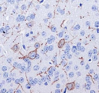 Immunohistochemistry: Neurokinin 1 Receptor Antibody [NB300-101] - Immunohistochemical analysis of Neurokinin 1 Receptor in mouse brain (selected cells, axon & dendrites) using NB300-101.
