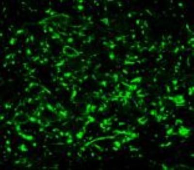Immunocytochemistry/Immunofluorescence: Neurokinin 1 Receptor Antibody [NB300-101] - IF analysis of Neurokinin 1 Receptor in rat brain tissue. Image courtesy of anonymous customer product review.