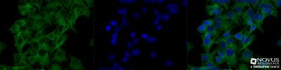 Immunocytochemistry/Immunofluorescence: Tubulin Antibody (YL1/2) [NB600-506] - HeLa cells were fixed and permeabilized for 10 minutes using -20C MeOH. The cells were incubated with anti-Tubulin (YL1/2) at a 1:200 dilution overnight at 4C and detected with an anti-rat Dylight 488 (Green) at a 1:500 dilution. Nuclei were counterstained with DAPI (Blue). Cells were imaged using a 40X objective.