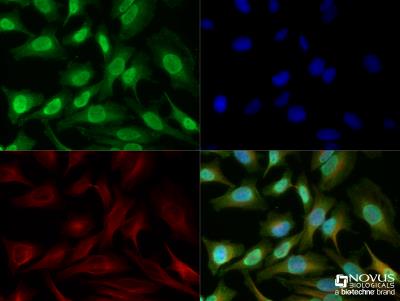 Immunocytochemistry/Immunofluorescence: HMGB1/HMG-1 Antibody [NB100-2322] - HeLa cells were fixed for 10 minutes using 10% formalin and then permeabilized for 5 minutes using 1X TBS + 0.5% Triton-X100. The cells were incubated with anti-HMGB1 [NB100-2322] at a 1:200 dilution overnight at 4C and detected with an anti-rabbit Dylight 488 (Green) at a 1:500 dilution. Alpha tubulin (DM1A) [NB100-690] was used as a co-stain at a 1:1000 dilution and detected with an anti-mouse Dylight 550 (Red) at a 1:500 dilution. Nuclei were counterstained with DAPI (Blue). Cells were imaged using a 40X objective.