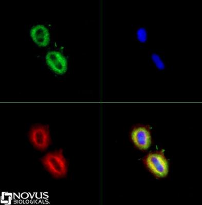 Immunocytochemistry/Immunofluorescence: Fatty Acid Synthase Antibody [NB400-114] - The Fas antibody was tested in MCF-7 cells at a 1:2000 dilution against Dylight 488 (Green). Alpha tubulin and nuclei were counterstained against Dylight 550 (Red) and DAPI (Blue), respectively.