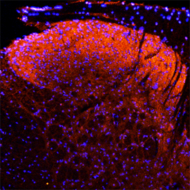 Neuropilin‑1 was detected in perfusion fixed frozen sections of rat spinal cord using Goat Anti-Rat Neuropilin‑1 Antigen Affinity-purified Polyclonal Antibody (Catalog # AF566) at 15 µg/mL overnight at 4 °C. Tissue was stained using the NorthernLights™ 557-conjugated Anti-Goat IgG Secondary Antibody (red; Catalog # NL001) and counterstained with DAPI (blue). Specific staining was localized to the dorsal horn. View our protocol for Fluorescent IHC Staining of Frozen Tissue Sections.