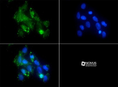 Immunocytochemistry/Immunofluorescence: CD11b/c Antibody [NB110-40766] - CD11 antibody was tested in Raw264.7 cells with FITC (green). Nuclei were counterstained with Dapi (blue).