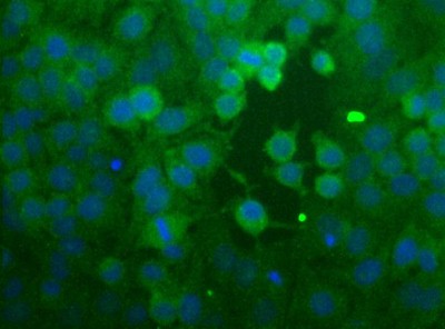 Immunocytochemistry/Immunofluorescence: CCR2 Antibody [NBP1-48337] - Analysis of CCR2 in HeLa cells