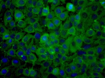 Immunocytochemistry/Immunofluorescence: PKM2 Antibody [NBP1-48308] - Immunocytochemical analysis of PKM2 in HeLa cells.