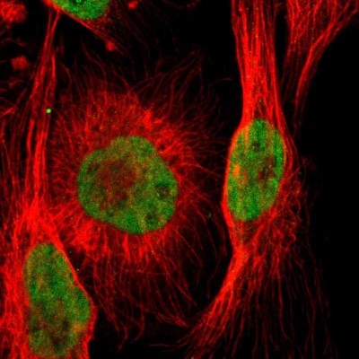 Immunocytochemistry/Immunofluorescence: ARID1A Antibody [NBP1-88932] - Staining of human cell line U-251 MG shows localization to nucleoplasm.