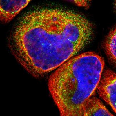 Immunocytochemistry/Immunofluorescence: ZNF410 Antibody [NBP1-89054] - Staining of human cell line A-431 shows positivity in endoplasmic reticulum & vesicles.