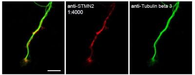 Immunocytochemistry/Immunofluorescence: Stathmin-2/STMN2 Antibody [NBP1-49461] - Staining of STMN2 in primary mouse dorsal root ganglia (DRG) neurons.  Shows the expected staining of endogenous STMN2 in axons and growth cones.  Tubulin is a marker of axons.  NBP1-49461 was used at a dilution of 1:4000.  Image courtesy of Dr. Jung Eun Shin.