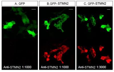 Immunocytochemistry/Immunofluorescence: Stathmin-2/STMN2 Antibody [NBP1-49461] - Staining of STMN2 in HEK293T cells transfected with GFP or a GFP-STMN2 fusion.  NBP1-49461 was used at a dilution of 1:1000 (A, B) and 1:3000 (C).  Image courtesy of Dr. Jung Eun Shin.