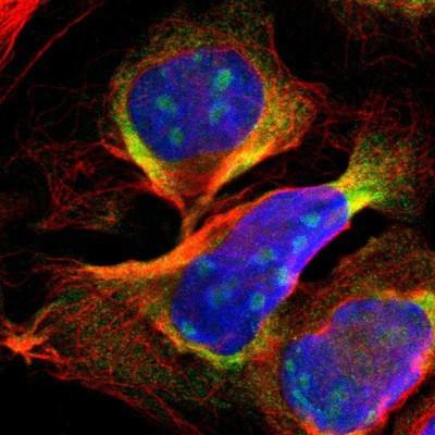 Immunocytochemistry/Immunofluorescence: DDX24 Antibody [NBP1-89472] - Staining of human cell line U-2 OS shows positivity in nucleoli & cytoplasm.
