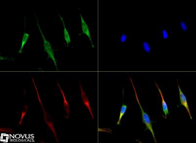 Immunocytochemistry/Immunofluorescence: SLC31A1/CTR1 Antibody [NB100-402] - CTR1 antibody was tested in NIH-3T3 cells with Dylight 488 (green). Nuclei and alpha-tubulin were counterstained with DAPI (blue) and Dylight 550 (red).
