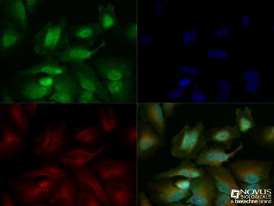 Immunocytochemistry/Immunofluorescence: Glut4 Antibody [NBP1-49533] - HeLa cells were fixed for 10 minutes using 10% formalin and then permeabilized for 5 minutes using 1X TBS + 0.5% Triton-X100. The cells were incubated with anti-GLUT4 [NBP1-49533] at a 1:200 dilution overnight at 4C and detected with an anti-rabbit Dylight 488 (Green) at a 1:500 dilution. Alpha tubulin (DM1A) NB100-690 was used as a co-stain at a 1:1000 dilution and detected with an anti-mouse Dylight 550 (Red) at a 1:500 dilution. Nuclei were counterstained with DAPI (Blue). Cells were imaged using a 40X objective.
