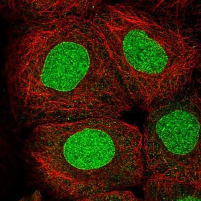 Immunocytochemistry/ Immunofluorescence: MRTO4 Antibody [NBP1-88334] -  Staining of human cell line A-431 shows positivity in nucleus & nuclear membrane.