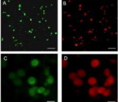 Immunocytochemistry/Immunofluorescence: Vanilloid R1/TRPV1 Antibody [NB100-1617] - CGRP and TRPV1 are co-expressed in most cultured trigeminal ganglion neurons. (A and C) CGRP expression in d2 trigeminal ganglion neurons plated on poly-d-lysine-coated coverslips. (B and D) The same culture shown in panel A or C costained for TRPV1 expression. Magnification bar = 200m (A and B) or 40m (C and D)