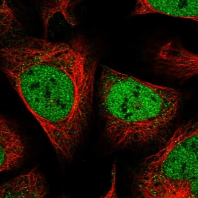 Immunocytochemistry/Immunofluorescence: ZEB1 Antibody [NBP1-88845] - Immunofluorescent staining of human cell line U-2 OS shows localization to nucleoplasm.