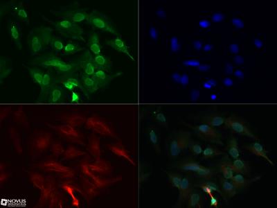 Immunocytochemistry/Immunofluorescence: DGAT1 Antibody [NB110-41487] - DGAT1 antibody (1:100) was tested in HepG2 cells with Dylight 488 (green). Nuclei and alpha-tubulin were counterstained with DAPI (blue) and Dylight 550 (red). Image objective 40x.