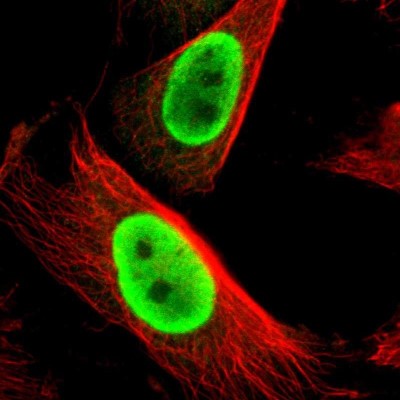 Immunocytochemistry/Immunofluorescence: FUS Antibody [NBP1-89113] - Immunofluorescent staining of human cell line U-251 MG shows localization to nucleoplasm.