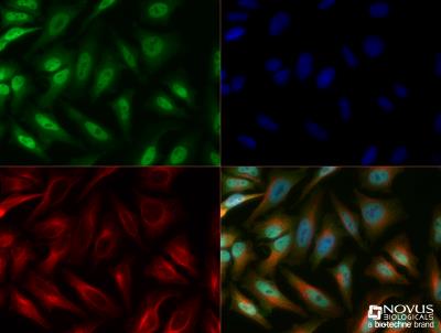 Immunocytochemistry/Immunofluorescence: LOX Antibody [NB100-2530] - HeLa cells were fixed for 10 minutes using 10% formalin and then permeabilized for 5 minutes using 1X TBS + 0.5% Triton-X100. The cells were incubated with anti-LOX [NB100-2530] at a 1:100 dilution overnight at 4C and detected with an anti-rabbit Dylight 488 (Green) at a 1:500 dilution. Alpha tubulin (DM1A) NB100-690 was used as a co-stain at a 1:1000 dilution and detected with an anti-mouse Dylight 550 (Red) at a 1:500 dilution. Nuclei were counterstained with DAPI (Blue). Cells were imaged using a 40X objective.