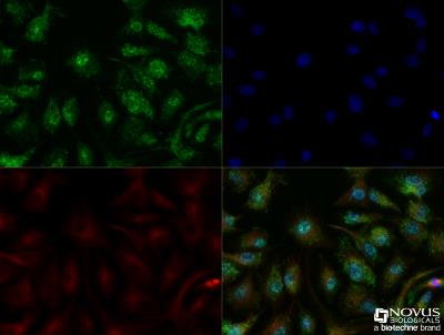 Immunocytochemistry/Immunofluorescence: Perilipin-2/ADFP Antibody [NB110-40877] - HepG2 cells were fixed for 10 minutes using 10% formalin and then permeabilized for 5 minutes using 1X TBS + 0.5% Triton-X100. The cells were incubated with anti-Perilipin-2/ADFP at a 1:100 dilution overnight at 4C and detected with an anti-rabbit Dylight 488 (Green) at a 1:500 dilution. Alpha tubulin (DM1A) NB100-690 was used as a co-stain at a 1:1000 dilution and detected with an anti-mouse Dylight 550 (Red) at a 1:500 dilution. Nuclei were counterstained with DAPI (Blue). Cells were imaged using a 40X objective.