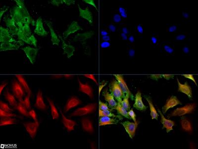 Immunocytochemistry/Immunofluorescence: MRP1 Antibody (IU2H10) [NB400-156] - The MRP-1 antibody was tested in HeLa cells at a 1:50 dilution against Dylight 488 (Green).  Alpha tubulin and nuclei were counterstained against Dylight 550 (Red) and DAPI (Blue), respectively.