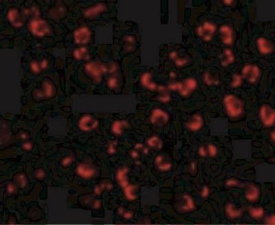 Immunofluorescence: PAK5 Antibody [NBP1-77237] - K562 cells with PAK5 antibody at 10 ug/mL.