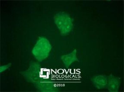 Immunocytochemistry/Immunofluorescence: OCT4 Antibody [NB100-2379] - OCT4 staining in NTERA-2 cells detected with a Dylight 488 labeled secondary antibody.