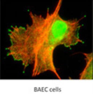 Immunocytochemistry/Immunofluorescence: myosin X Antibody [22430002] - staining of Myo10 at a dilution of 1:800 with 1.0mg/mL stock overlapped with immunofluorescence staining of Actin at a dilution of 1:800. Image courtesy of MM DiVito and RE Cheney, Department of Cell and Molecular Physiology, University of North Carolina at Chapel Hill.