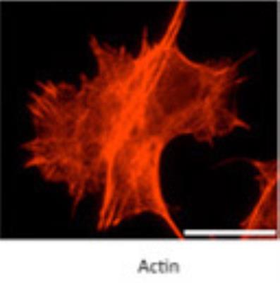 Immunocytochemistry/Immunofluorescence: myosin X Antibody [22430002] - staining of Actin at a dilution of 1:800. Image courtesy of MM DiVito and RE Cheney, Department of Cell and Molecular Physiology, University of North Carolina at Chapel Hill.