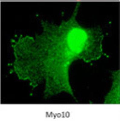 Immunocytochemistry/Immunofluorescence: myosin X Antibody [22430002] - Myosins are actin-based motor molecules with ATPase activity. MYO10 plays a role in regions of dynamic actin and is presumed to serve in intracellular movements. Immunofluorescence staining of Myo10 at a dilution of 1:800 with 1.0 mg/mL stock. Image courtesy of MM DiVito and RE Cheney, Department of Cell and Molecular Physiology, University of North Carolina at Chapel Hill.