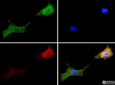 Immunocytochemistry/Immunofluorescence: TRPV1 Antibody [NBP1-97417] - TRPV1 antibody was tested in Ntera-2 cells with FITC (green). Nuclei and alpha-tubulin were counterstained with DAPI (blue) and Dylight 550 (red).